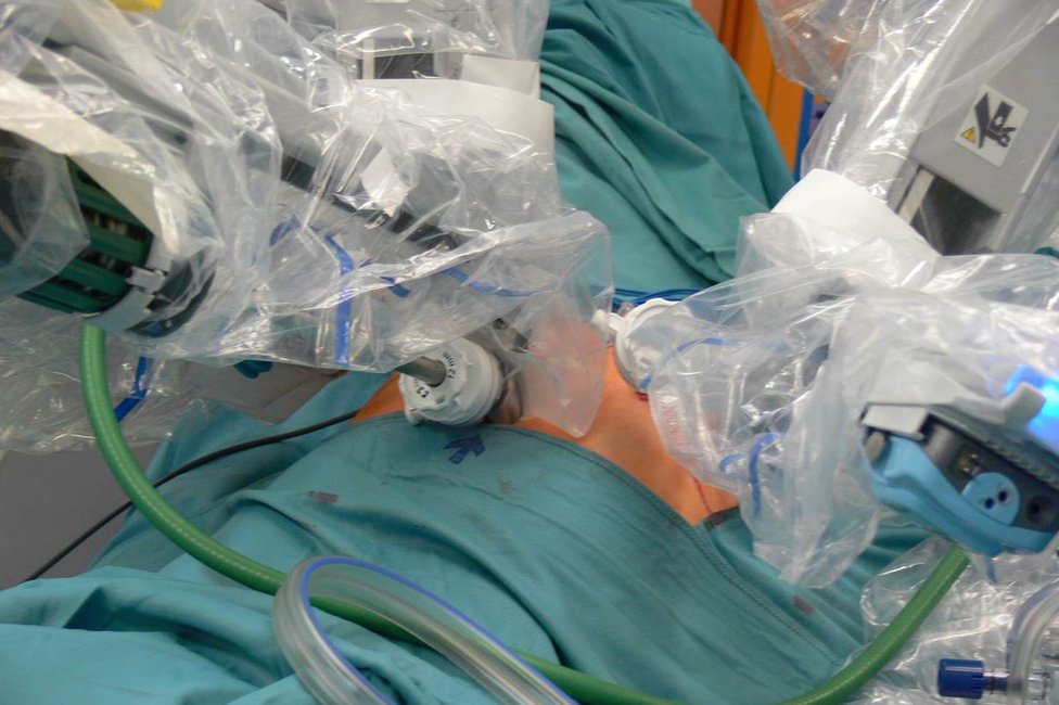 Endometriosezentrum/Meduni Wien Bild v. OP mit DaVinci-Roboter